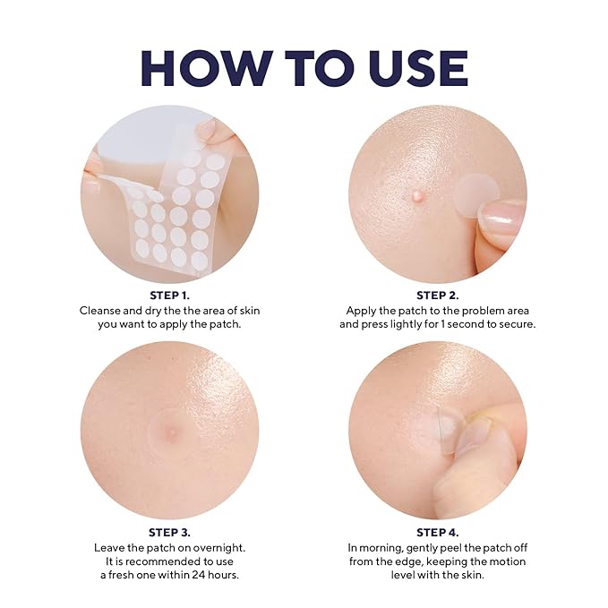 caraseoul Overnight Pimple Patches, Thicker & Extra Adhesion, 2 Size Hydrocolloid Acne Patch for Zits and Blemishes, Bakuchiol & Aloe Vera, Korean Skin Care, Easy to Use – Dermatology Tested