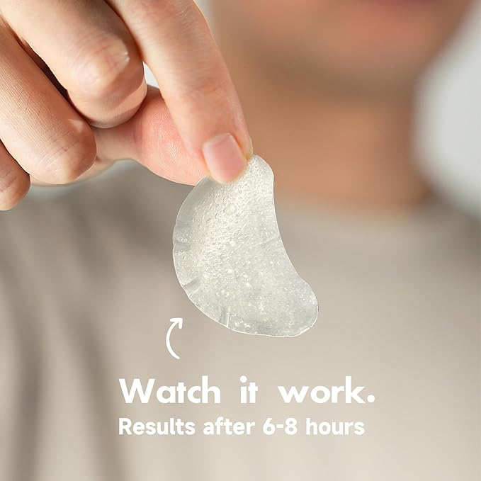 Ultra Pimple Patch Variety Pack Hydrocolloid Acne Pimple Patches with Salicylic Acid for Covering Small & Large Zits and Blemishes, Spot Stickers for Face and Skin (36 Counts)