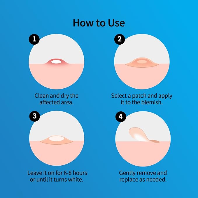 Pimple Patches for Face Hydrocolloid Acne Patches, Invisible Zit Stickers Covering Blemishes, 3 Size Hydrocolloid Spot Stickers for Face and Skin (144 Count(Pack of 1))