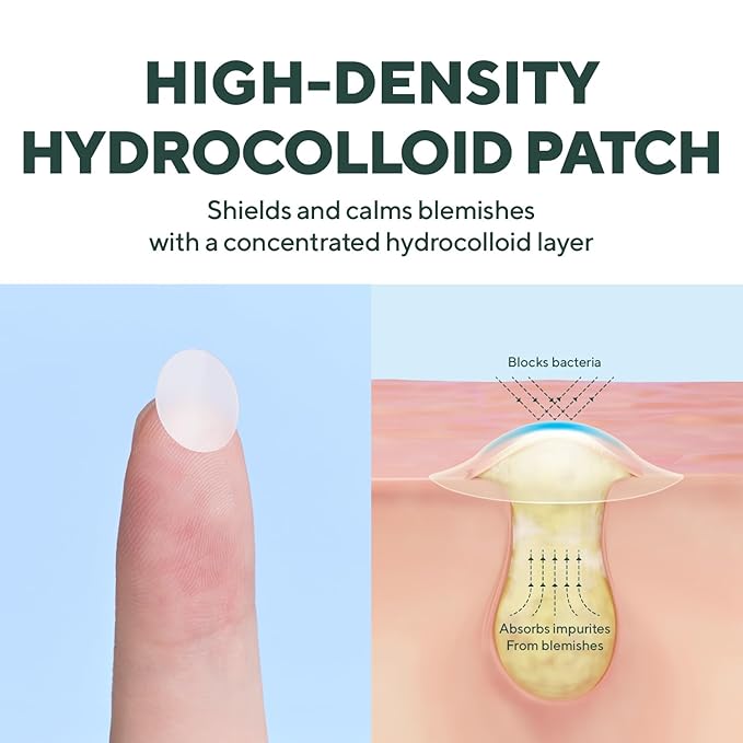 caraseoul Overnight Pimple Patches, Thicker & Extra Adhesion, 2 Size Hydrocolloid Acne Patch for Zits and Blemishes, Bakuchiol & Aloe Vera, Korean Skin Care, Easy to Use – Dermatology Tested