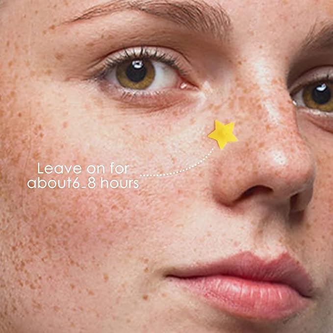 Star Pimple Patches - 300 Patches Hydrocolloid Patches, Star Shape Spot Dots,Yellow & Blue Blemish Patch, Cute Face Stickers
