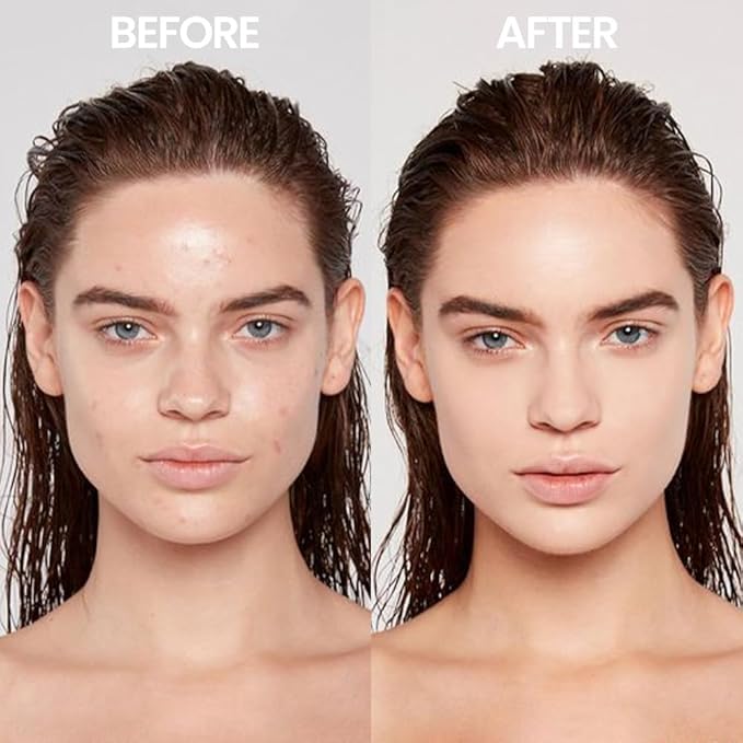 Kaely Dual-Ended Concealer Stick,Acne Dark Spot Corrector Makeup Brightener Waterproof,ight+Neutral 01 L