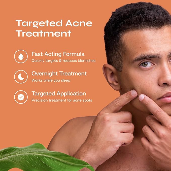 Bio Clean Drying Lotion Best for Treating Pimples Best for Oily Skin Prevents Dryness and Flakiness Pimple Lotion Spot Treatment .68 fl. oz. 20 ml