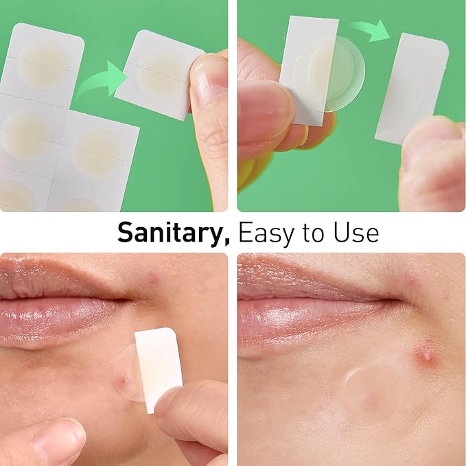 Pimple Patches, 15 mm Invisible Acne Patches for Face with Salicylic Acid, 0.01cm Extra Thin Outer Edge, Hydrocolloid Zit Patch for Pustule, Whitehead, Cystic Acne Spot, 96 Count