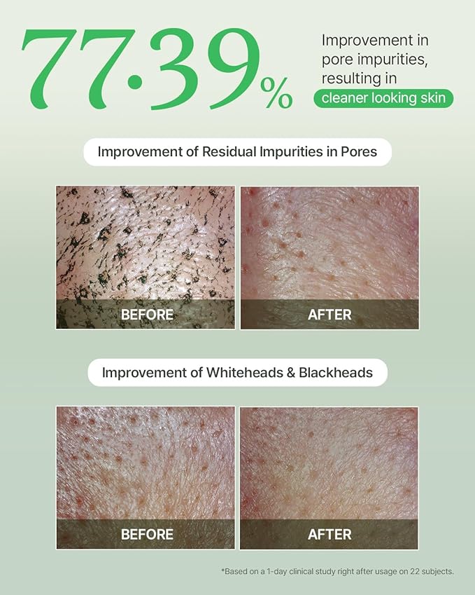 FULLY Green Tomato Pore Detox Clay Mask Cleanser, Pore Minimizing, Blackhead Care, Sebum Control, Exfoliation, Vegan, Face Wash, Sensitive Skin, Korean Skincare 4.05 fl.oz