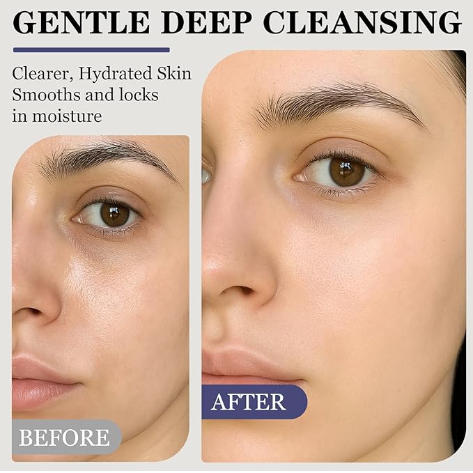 SINPIN aobenz Gentle Face Cleanser with Scrubber - Foaming Facial Cleanser for Dry, Sensitive, Oily, Acne Skin | Natural Face Wash for Women & Men, Niacinamide & Hyaluronic Acid | Hydrating, 3.38 FL