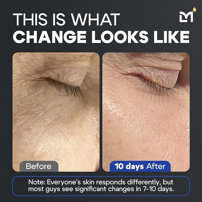 Titan Anti-Aging Peptides Serum for Face - High Potency Mens Peptide Serum Moisturizer - Mens Skin Care - Men, Dark Spots, Wrinkles, Fine Lines - Peptides, 5% Niacinamide, HA - Unscented