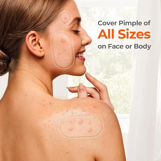 TKTK 609 Count Pimple Patches for Face, Hydrocolloid Acne Patch Bulk, Acne Stickers for Covering Cheeks, Forehead, Chin Blemishes Zit Breakouts for All Skin Types (Dots, Strip, Contoured 5 Sizes)