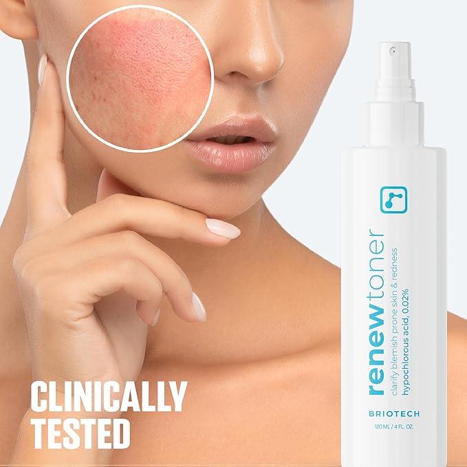 BRIOTECH Renew Toner, Hypochlorous Acid Spray, Minimize Appearance of Blemishes, Soothing Facial Mist for Sensitive Skin, Calm Redness & Bumps, Hypoallergenic & Vegan, 2 fl oz Travel Size