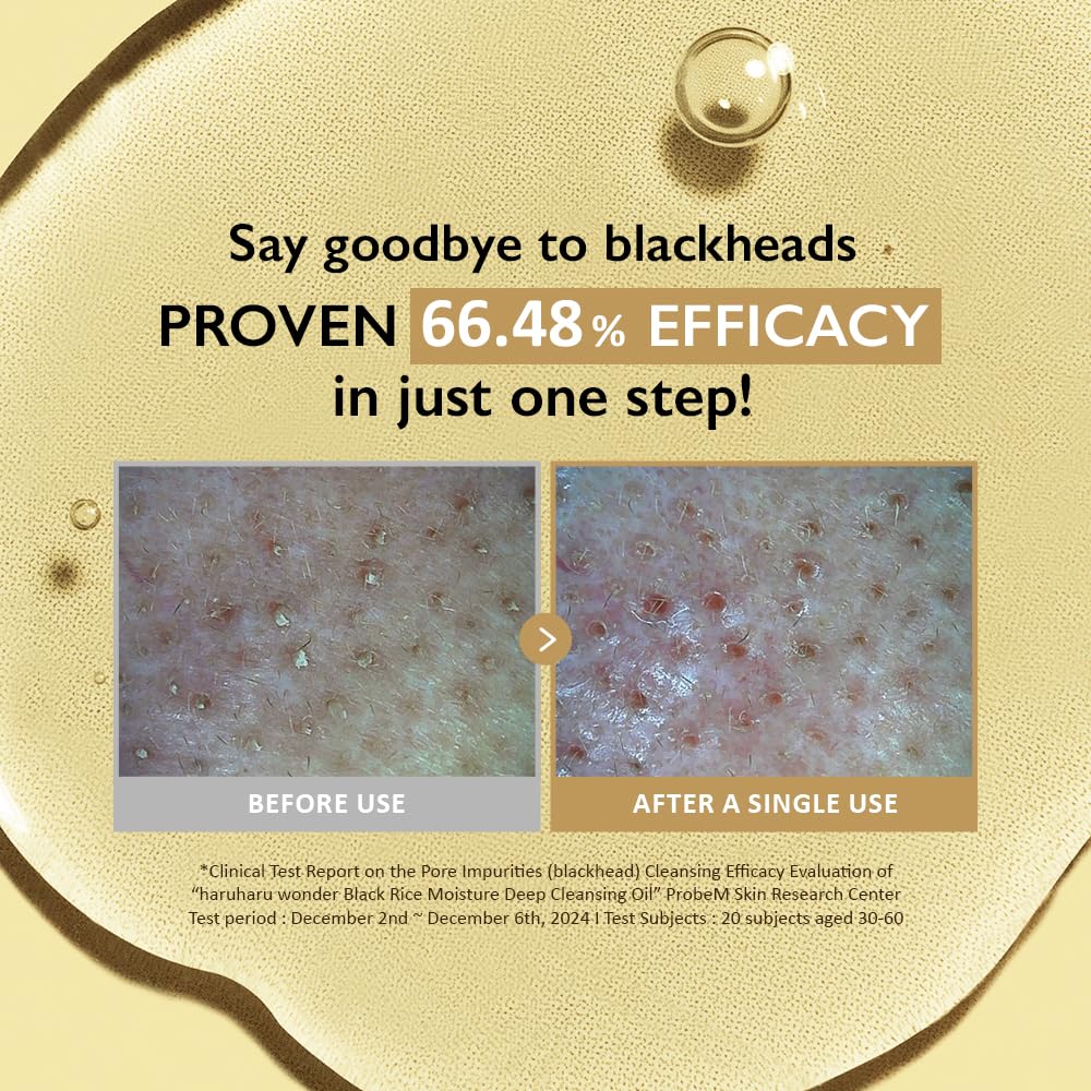 HARUHARU wonder Black Rice Moisture Cleansing Oil, 5.1 fl oz, Double Cleansing, Daily Makeup remover, Pore Oil Cleanser, Korean Skincare for sensitive, normal and Oily Skin