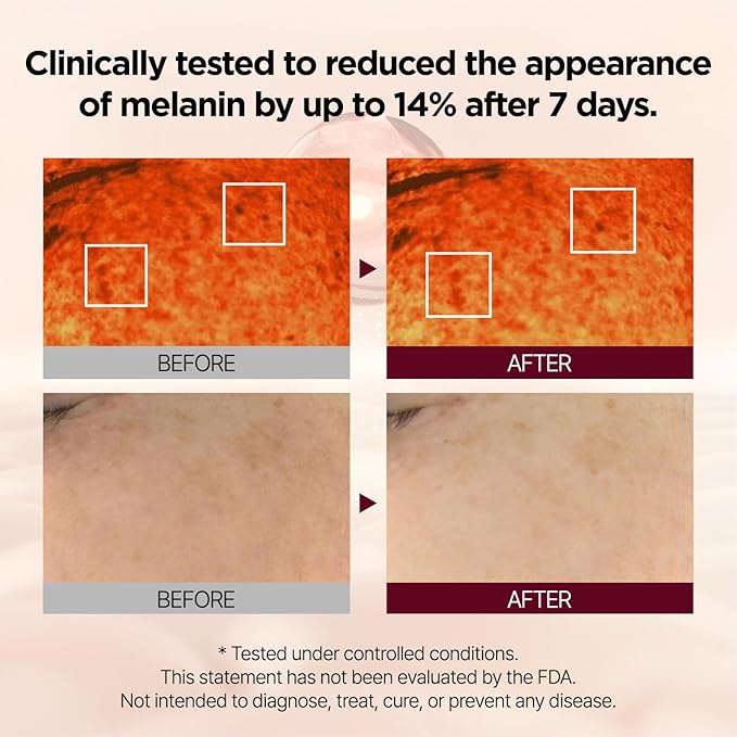 PONGDANG Midnight Mela Reset Vita 23 | 23% Highly Concentrated Liposomal Vitamin C Serum | Maximum Strength Dark Spot Remover for Face | Korean Skin Care