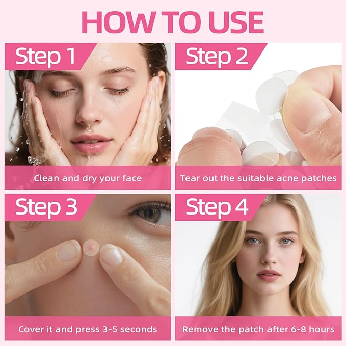 Pimple Patches for Face, 300pcs 4 Size Hydrocolloid Acne Patches for Covering Zits and Blemishes, Hydrocolloid Patch with Salicylic Acid, Tea Tree Oil and Calendula Oil