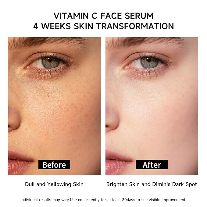 Vitamin C Face Serum with Glutathione, 4D Hyaluronic Acid, Organic Aloe Vera, Travel Size Ampoule, Brightening and Hydrating Serum, Dark Spot Remover, 30 Ampoules (1ml each)