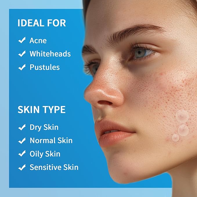 Pimple Patches for Face Hydrocolloid Acne Patches, Invisible Zit Stickers Covering Blemishes, 3 Size Hydrocolloid Spot Stickers for Face and Skin (216 Count(Pack of 1))