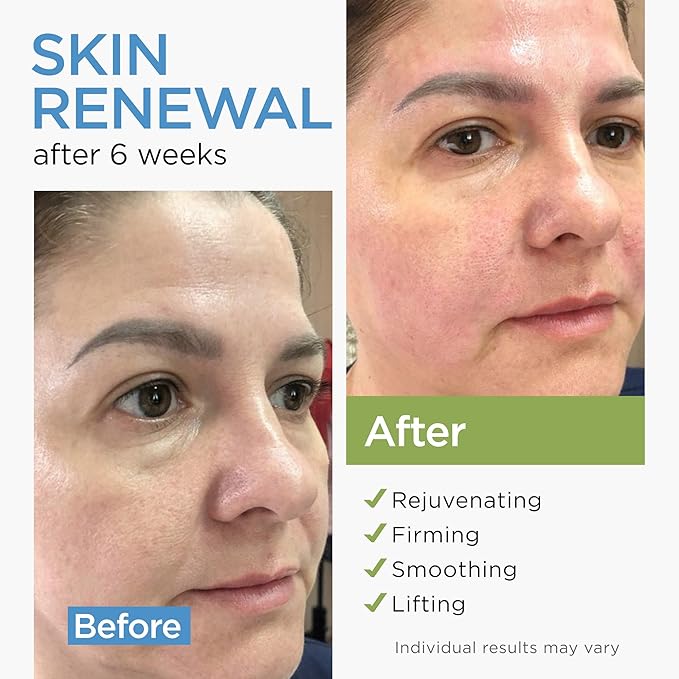 Collagen Cream for Face with Stem Cells Retinol Hyaluronic Acid Niacinamide for All Skin Types - Anti-Aging Face Moisturizer with Airless Pump - Day & Night Cream for Wrinkles - Made in USA 1.7 Oz