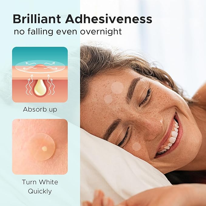 Pimple Patch Acne Patch, 4 Sizes 140 Patches Acne Absorbing Cover Patch, Hydrocolloid Invisible Acne Patches for Face Zit Patch Acne Dots Tea Tree, Calendula Oil