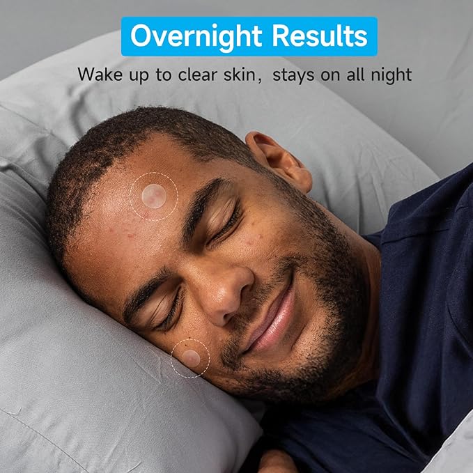 Pimple Patches for Face (504 Count), FSA Eligible Acne Patch Bulk, Zit Stickers 4 Sizes, Hydrocolloid Spot Stickers, Clear Acne Dots for Covering Zits, Blemishes and Breakouts