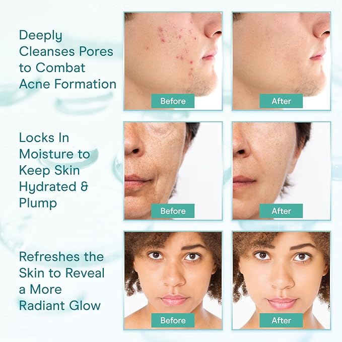 Baebody Cleansing Milk for Face - Vegan Facial Cleanser for Women and Men - Micellar Makeup Remover - Milk Cleanser Face Wash (8 fl oz)