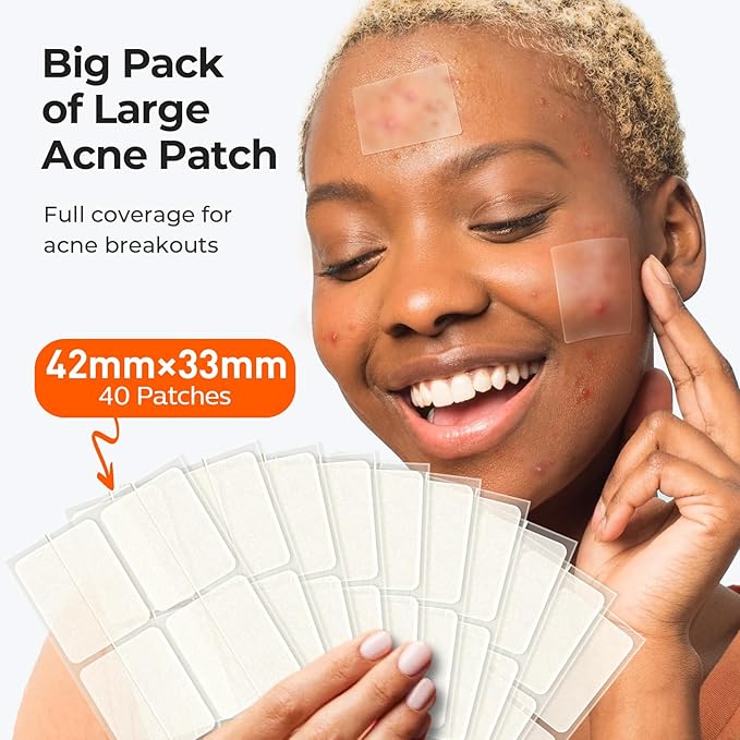 TKTK Large Pimple Patches (5 Sizes, 92 Patches), Hydrocolloid Acne Patches, XL Zit Patches for Face, Forehead, Chin, Nose, Body, Back, Chest, Rectangular, Square, and Dot Hydrocolloid Bandages