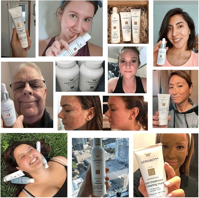 LEROSETT ClearPoint Anti Acne Pills, Natural Supplements for Hormonal & Cystic Acne Treatment for Oily Skin & Breakouts. 60 Caps