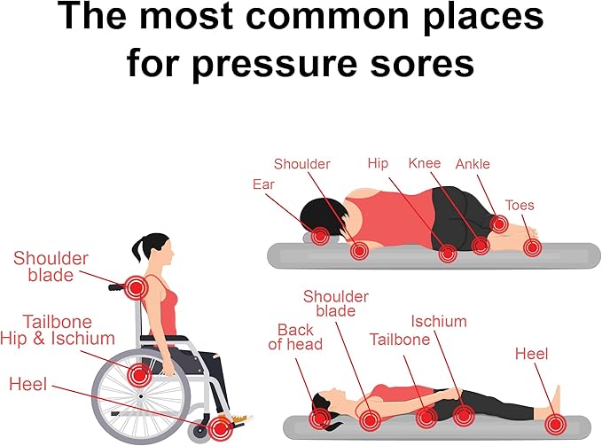 TriDerma MD Pressure Sore Relief Healing Cream for Bed Sores, Pressure Sores, Wound Healing, Chafed Skin and Hard-to-Heal Skin Sores with Calendula and AP4 Aloe Vera Gel, 4 oz Tube