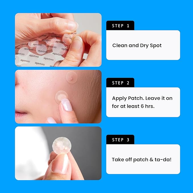AVARELLE Pimple Patches for Face | Hydrocolloid Acne Patches for Covering Blemishes | Zit Patches with Tea Tree, Calendula, & Cica | HSA Store Eligible Items (10-14 mm, 80 Count)