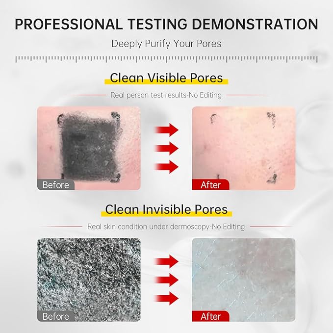 VGO Facial Cleanser, Daily Face Wash for Deep Pore Cleanser and Makeup Remover for Sensitive Oily Skin, Double Tube Design with Hyaluronic Acid, 3.52 Oz