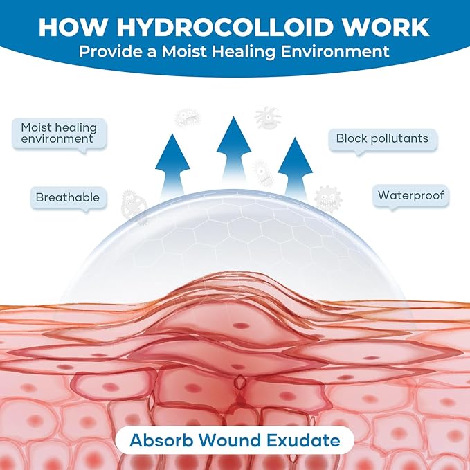 Hydrocolloid Bandages Roll: 2in x 16ft Ultra Adhesivas & Absorbent & Waterproof Large Hydrocolloid Patches for Wound Care - Hydro Seal Wound Healing Hydrocolloid Dressing Bandaid Tape