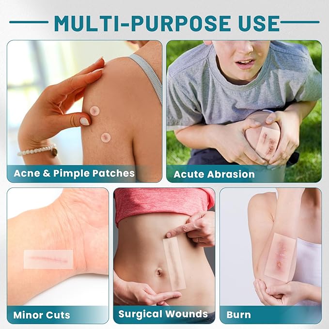 WUYUAN Hydrocolloid Roll for Wound Care, 2in*16.5ft Hydrocolloid Bandages with Self-Adhesive, Extra Large Hydrocolloid Patch Bandages Cut-to-Size, Ultra Absorbent, Waterproof