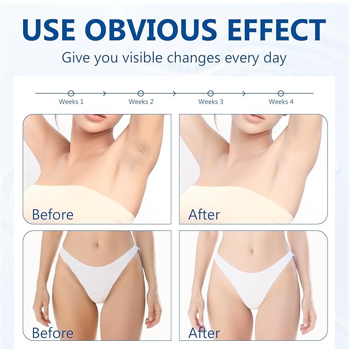 Skin Bleaching Cream-for Intimate Areas & Body, Skin Care Lightening Cream-for Private Parts, Underarms, Knees, Elbows, Inner Thighs, Bikini Areas, Dark Spot Remover for Face(4.0 Fl Oz)