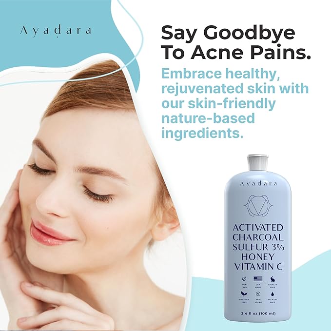 Severe Acne Charcoal Face Wash, 3.4 oz, Daily Cleanser with Sulfur and Honey, Face Cleanser for Acne, Deep Cleansing Charcoal Face Wash for Women and Men, 200 Uses