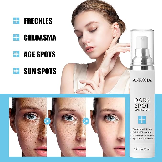 Dark Spot Remover for Face and Body Serum Promotes Anti-Aging Effect, Dark Spot Corrector for Women and Men with Niacinamide,Kojic Acid & Salicyic Acid 50ml /1.7fl oz