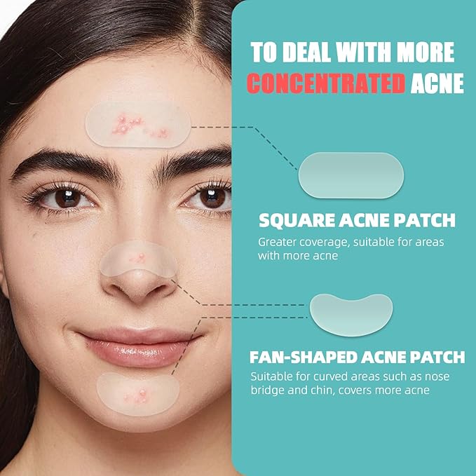 New Pimple Patches for Face, 3 Different Sizes Hydrocolloid Acne Patches, Pimple Patch Pimple Stickers for Covering Zits and Blemishes, Zit Patches Sticker for Face and Skin (X35 X2 X3)