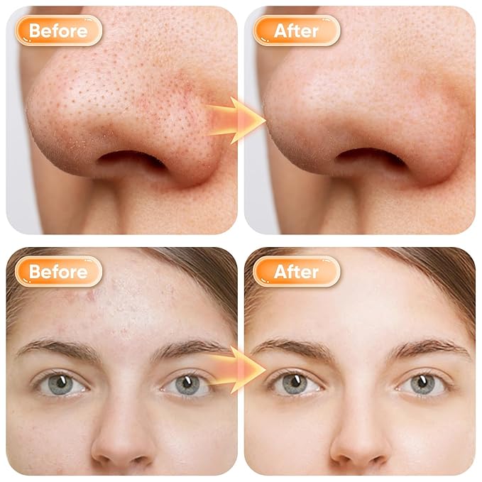 Turmeric Face Wash with Brush,Turmeric Facial Cleanser Foam,Foaming Face Cleanser,Deep Cleansing face Wash for All Type,3.38 fl.oz/pc