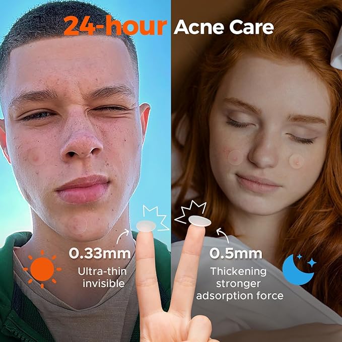 TKTK Bulk Pimple Patches for Face, 723 Patches 4 Size Acne Patches Day and Night, Hydrocolloid Patch Thin & Thick Pimple Stickers for Covering Zits, Blemishes and Breakouts