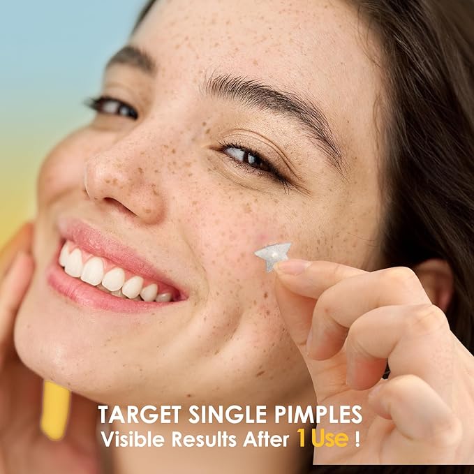 AUSLKA SHINING Star Pimple Patches -Hydrocolloid Patch for Covering Zits and Blemishes, Pimple Patches Cute, Spot Stickers for Face and Skin (180 Count)