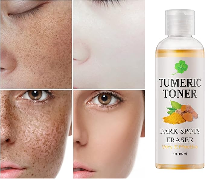 Toner for Dark Spots Turmeric Dark Spot Corrector Toner, Facial Toner for Acne Prone Skin, Dark Spot Remover for Face Hydrating Face Toner for Women, Moisturizing Toner Face for Dry Oily Skin- 4OZ