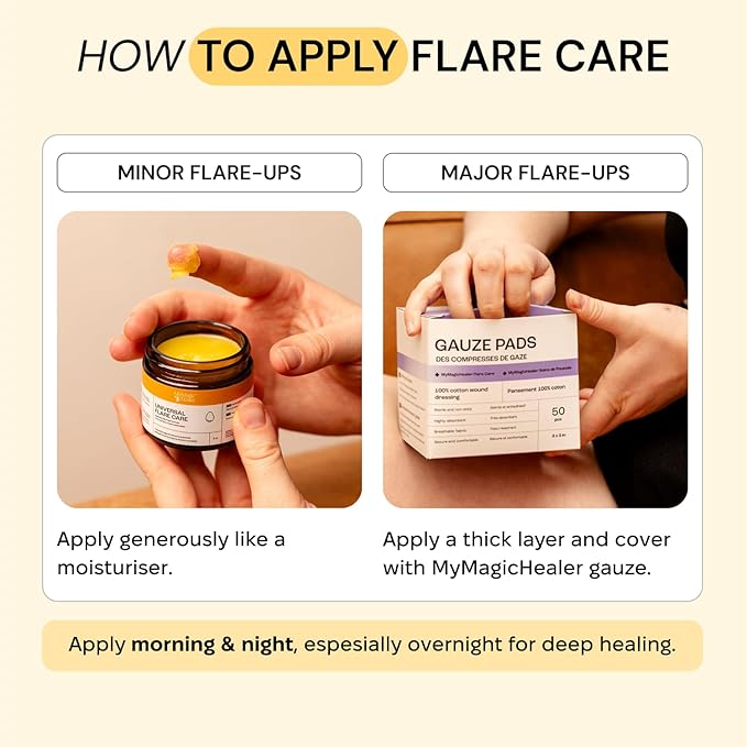 Universal Flare Care | Essential Oil Free | Relief for 100+ Skin Issues | Eczema, Dermatitis, Psoriasis, Rashes, Baby's Skin Issues, Hidradenitis, Chafing, Sores, Wounds | With Propolis & Egg Yolk 4oz