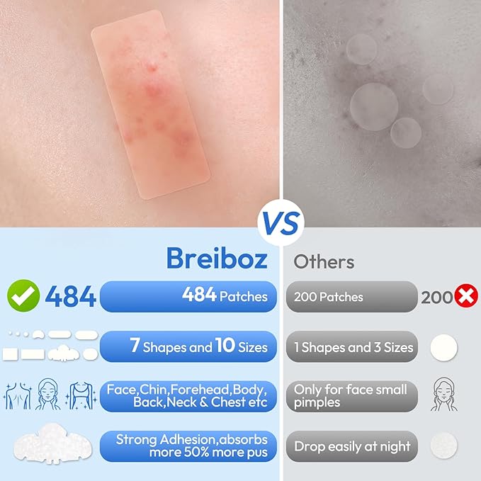 Large Pimple Patches Full Face,484 Patches,XL Acne Patches,Big Hydrocolloid Bandages for Body, Forehead, Chin, Neck Zit Breakouts w/Tea Tree, Salicylic Acid & Cica Oil|,Freely Customized Pimple Patch
