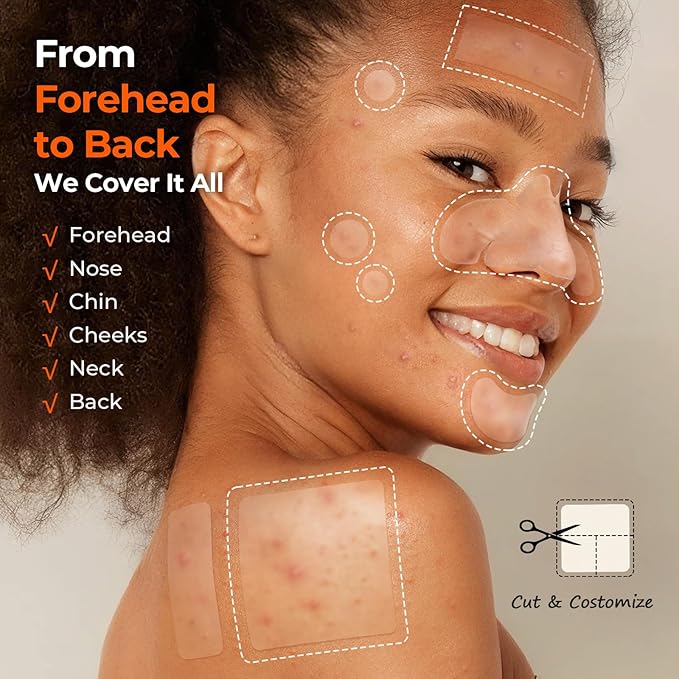 TKTK Pimple Patches for Face, 6 Sizes Hydrocolloid Acne Patch Variety, Large Acne Stickers for Cheeks, Forehead, Chin, Nose, Back Blemishes Zit Breakouts (4 Shapes 356 Count)