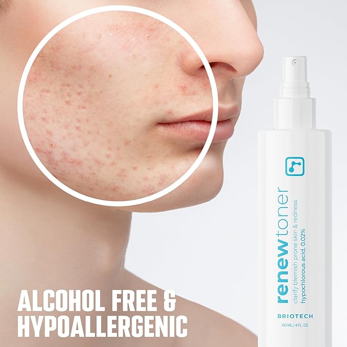 BRIOTECH Renew Toner, Hypochlorous Acid Spray, Minimize Appearance of Blemishes, Soothing Facial Mist for Sensitive Skin, Calm Redness & Bumps, Hypoallergenic & Vegan, 2 fl oz Travel Size