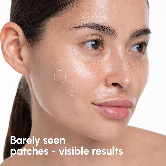 MAREE Pimple Patches for Face - Acne Clearing Device - Clear Acne Patches for Face - Invisible Hydrocolloid Patch Parches Para Acne Stickers Zit Dots - Cystic Zit Healing Blemish Pinple Covers