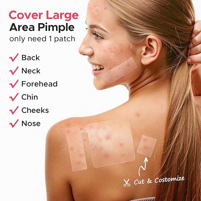 LitBear Large Pimple Patches, (5 Sizes 404 Counts) Big Acne Patches, Big Hydrocolloid Bandages for Body, Back, Face, and Chest, Zit Patches for Large Breakouts, Hydrocolloid Patch (XL Strip, Square)