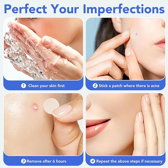 Pimple Patches for Face,Acne Patches for Face,Pimple Patch,Zit Patches,Hydrocolloid Blemish Patches for Covering Zits ,with Salicylic Acid,Tea Tree oil & Calendula oil (106 Counts, Count, 106.0)