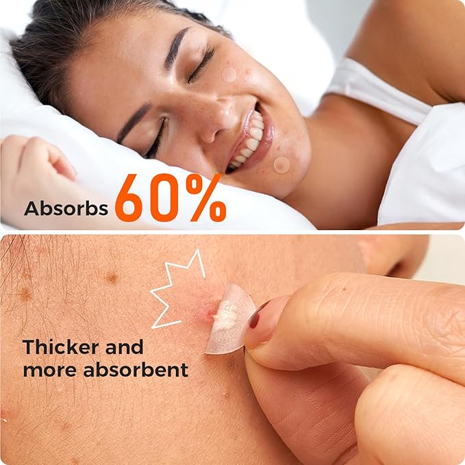 TKTK Bulk Pimple Patches for Face, 435 Patches 4 Size Acne Patches Day and Night, Hydrocolloid Patch Thin & Thick Pimple Stickers for Covering Zits, Blemishes and Breakouts