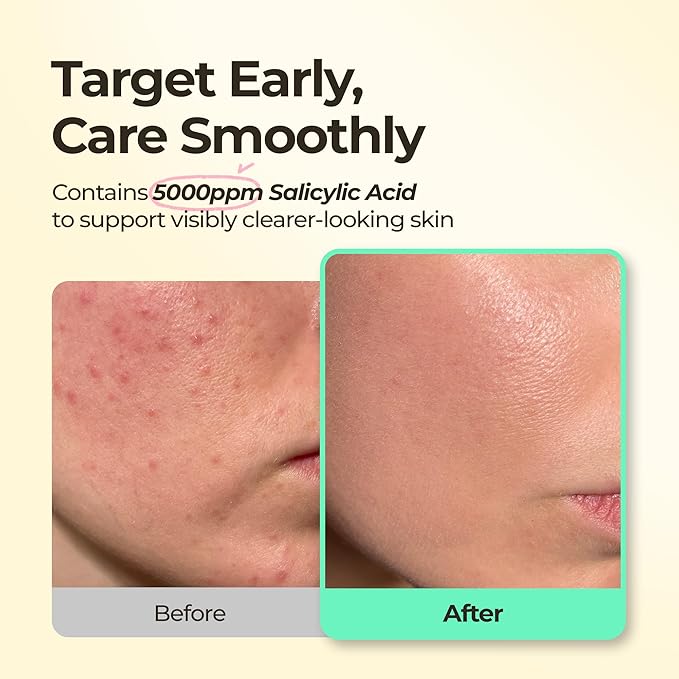 BHA Iconic Spot Patch - Hydrocolloid Patches with 5,000ppm Salicylic Acid - Day & Night Zit Patch for Targeted Sebum Care & Stylish Wear (36 EA)