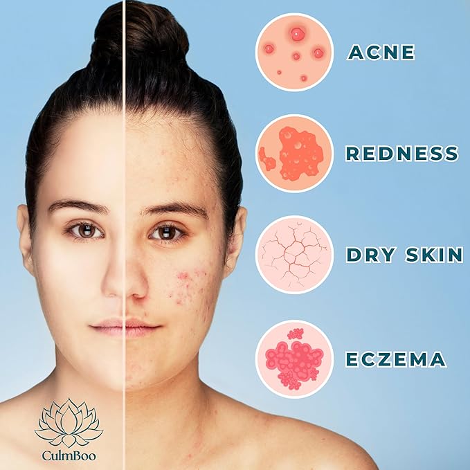 Hypochlorous Acid Spray for Face & Skin - Acne Prone Skin, Eczema, Natural Tattoo Aftercare, Piercing Aftercare Spray, Eye Lash Cleanser, Face Mist Toner, Wound Care Cleanser, 16 Fl Oz 1 Pack