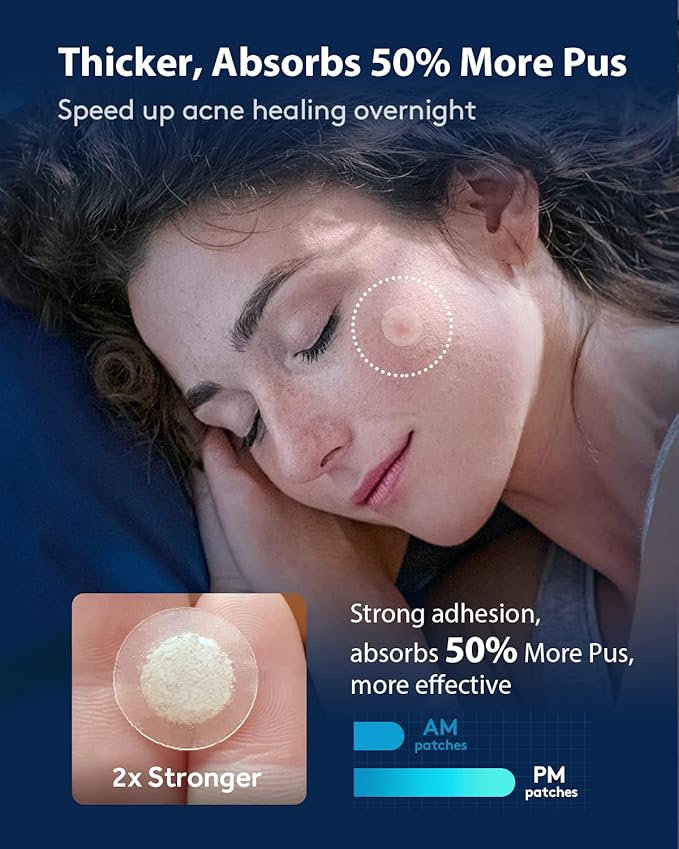 LitBear Acne Pimple Patches- Day and Night 4 Sizes 360 Dots Thin & Thick Hydrocolloid Patches with Witch Hazel, Tea Tree & Calendula Oil, Extra Adhesion Pimple Patches for Face Zit Patch Acne Dots