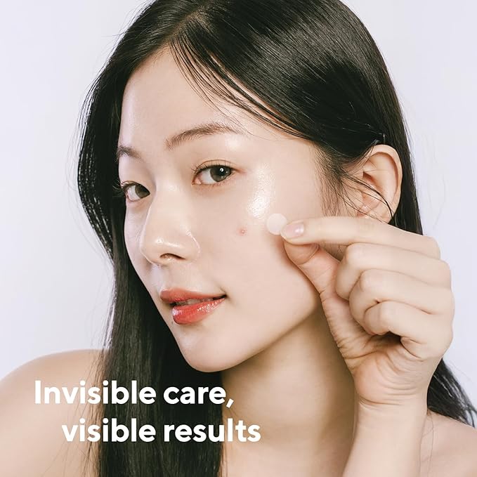 caraseoul Overnight Pimple Patches, Thicker & Extra Adhesion, 2 Size Hydrocolloid Acne Patch for Zits and Blemishes, Bakuchiol & Aloe Vera, Korean Skin Care, Easy to Use – Dermatology Tested