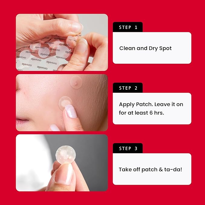 AVARELLE Acne Pimple Patch (40 Count) Absorbing Hydrocolloid Spot Treatment with Tea Tree Oil, Calendula Oil and Cica, Certified Vegan, Cruelty Free (VARIETY / 40 COUNT)